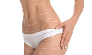 Endermologia: Odkryj sekret gładkiej skóry i jędrnej sylwetki.