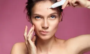 Jak szybko pozbyć się pryszcza? Apteczne i domowe triki