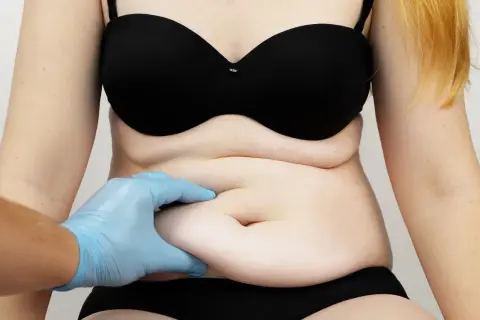 Liposukcja: Jak bezpiecznie wymodelować sylwetkę? Pełny przewodnik