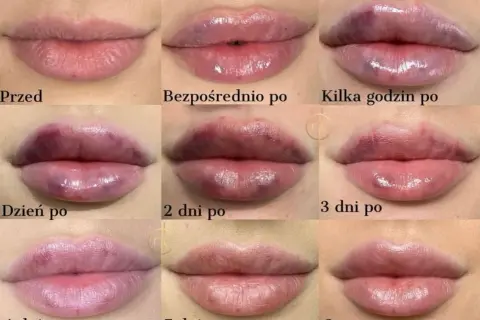 Jak usunąć wąsik? Porównanie metod: ból, koszt, efekty