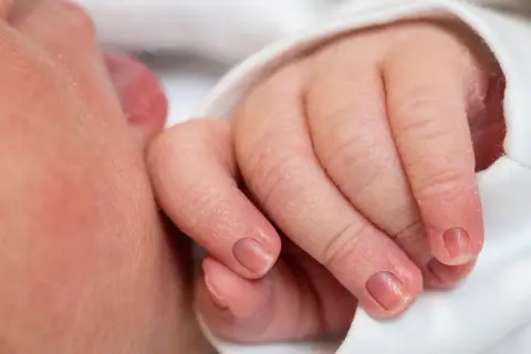 Delikatna dłoń niemowlaka, z widocznym paznokciem, który zaczyna się lekko zaginać.