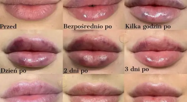Jak usunąć wąsik? Porównanie metod: ból, koszt, efekty