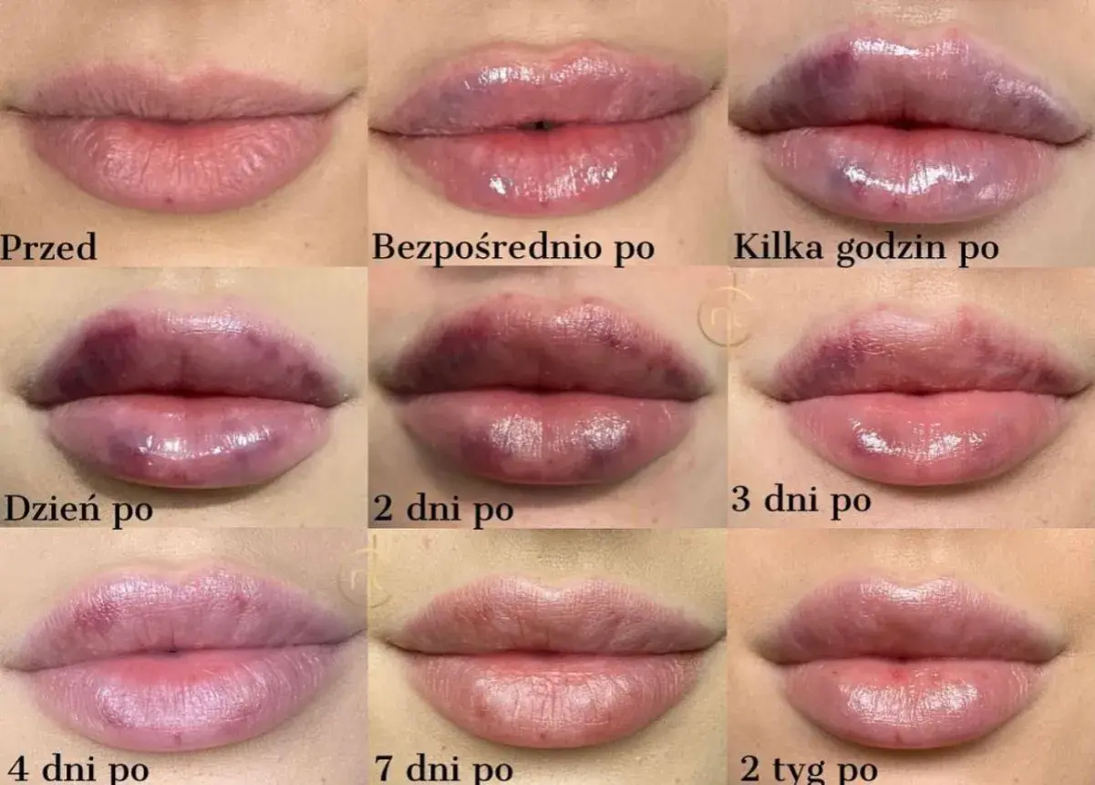 Jak usunąć wąsik? Porównanie metod: ból, koszt, efekty