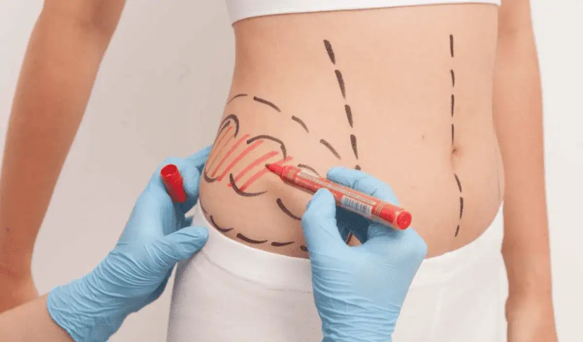 rodzaje znieczulenia liposukcja